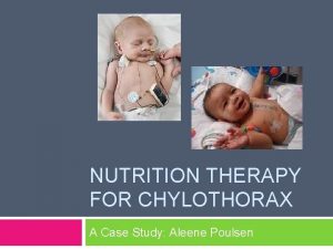 NUTRITION THERAPY FOR CHYLOTHORAX A Case Study Aleene