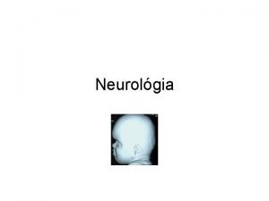 Neurolgia Anencephalia Microcephalus Agykoponya mrete kicsi Anyai alkohol