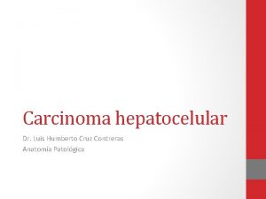 Carcinoma hepatocelular Dr Luis Humberto Cruz Contreras Anatoma