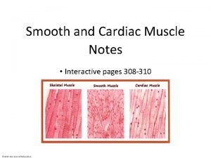 Smooth and Cardiac Muscle Notes Interactive pages 308