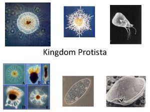 Kingdom Protista What are protist Eukaryotes Mostly Unicellular