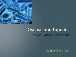 Disease and Injuries Broken BonesDislocations By Woochang Jung