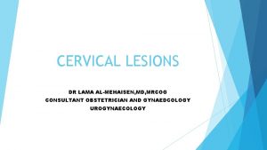 CERVICAL LESIONS DR LAMA ALMEHAISEN MD MRCOG CONSULTANT