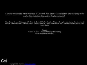 Cortical Thickness Abnormalities in Cocaine AddictionA Reflection of