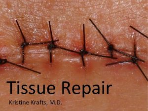 Tissue Repair Kristine Krafts M D Tissue Repair