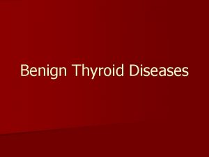 Benign Thyroid Diseases History n Goiter n Thyroid