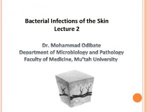 Bacterial Infections of the Skin Lecture 2 Staphylococcus