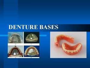 DENTURE BASES The denture base is that part