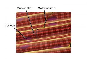 Muscle fiber Nucleus Motor neuron Sarcolemma Myofibrils Sarcoplasmic