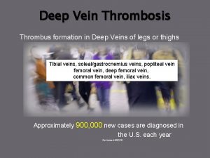 Deep Vein Thrombosis Thrombus formation in Deep Veins