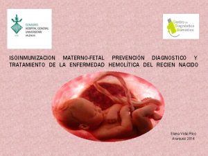 ISOINMUNIZACION MATERNOFETAL PREVENCIN DIAGNOSTICO Y TRATAMIENTO DE LA