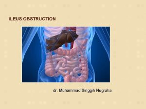 ILEUS OBSTRUCTION dr Muhammad Singgih Nugraha Definisi Ileus