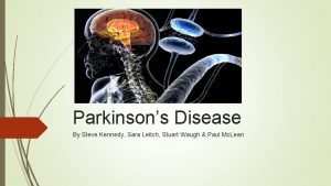 Parkinsons Disease By Steve Kennedy Sara Leitch Stuart