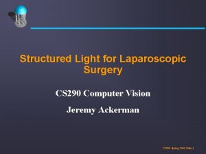 Structured Light for Laparoscopic Surgery CS 290 Computer