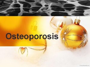 Osteoporosis OUTLINE Definition Pathophysiology Risk factor Causes Signs