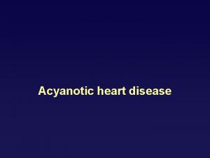 Acyanotic heart disease Incidence Incidence is 81000 live