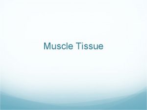 Muscle Tissue Types of Muscle Tissue Skeletal muscle