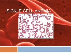 SICKLE CELL ANEMIA What is Sickle Cell People