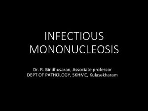 INFECTIOUS MONONUCLEOSIS Dr R Bindhusaran Associate professor DEPT