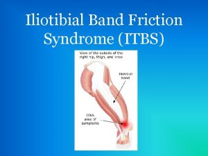 Iliotibial Band Friction Syndrome ITBS e m p