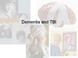 Dementia and TBI Dementia Which statement is true