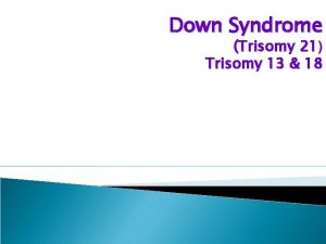 Down Syndrome Trisomy 21 Trisomy 13 18 What