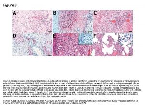 Figure 3 Histologic lesions and immunohistochemical detection of