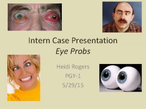 Intern Case Presentation Eye Probs Heidi Rogers PGY1