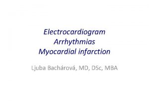 Electrocardiogram Arrhythmias Myocardial infarction Ljuba Bachrov MD DSc