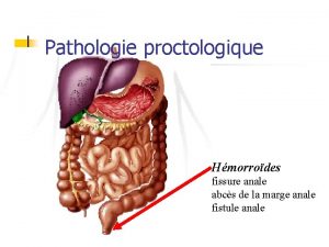 Pathologie proctologique Hmorrodes fissure anale abcs de la