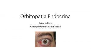 Orbitopatia Endocrina Roberto Rizzo Chirurgia Maxillo Facciale Trieste