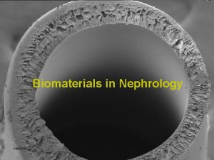 Biomaterials in Nephrology 1162022 1 Hollow Fibers l
