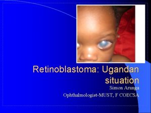 Retinoblastoma Ugandan situation Simon Arunga OphthalmologistMUST F COECSA
