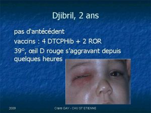 Djibril 2 ans pas dantcdent vaccins 4 DTCPHib