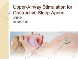 UpperAirway Stimulation for Obstructive Sleep Apnea 31914 Satomi
