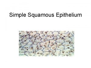 Simple Squamous Epithelium Simple Cuboidal Epithelium Simple Columnar
