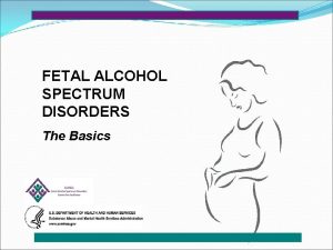 FETAL ALCOHOL SPECTRUM DISORDERS The Basics DEFINITION OF