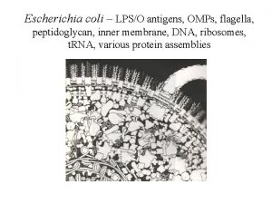 Escherichia coli LPSO antigens OMPs flagella peptidoglycan inner