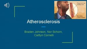 Atherosclerosis Braden Johnson Nor Schorn Caitlyn Cornelli Why