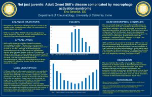 Not just juvenile Adult Onset Stills disease complicated