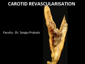 CAROTID REVASCULARISATION Faculty Dr Sanjay Prakash Schema of