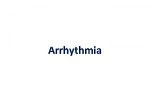 Arrhythmia Arrhythmia is defined as loss of cardiac