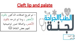 Cleft lip and palate Dr Saleh Abualhaj Plastic