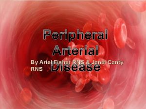 Peripheral Arterial By Ariel Fisher RNS Janel Canty