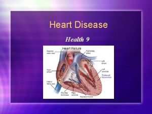 Heart Disease Health 9 Risk Factors for Heart