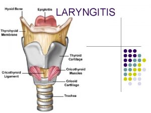 LARYNGITIS DEFINITION It is the inflammation of larynx