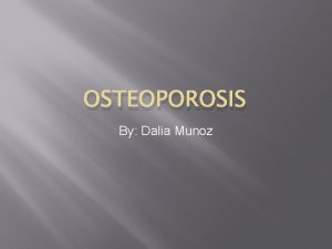OSTEOPOROSIS By Dalia Munoz What causes Osteoporosis Osteoporosis