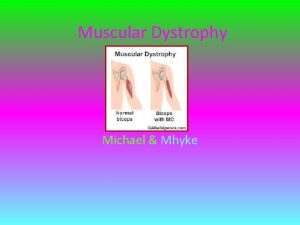 Muscular Dystrophy Michael Mhyke Symptoms The symptoms are