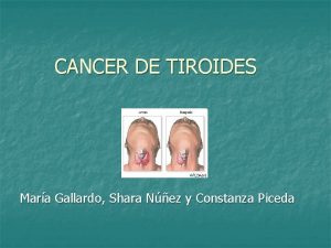 CANCER DE TIROIDES Mara Gallardo Shara Nez y