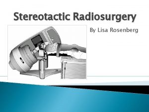 Stereotactic Radiosurgery By Lisa Rosenberg What is Stereotactic